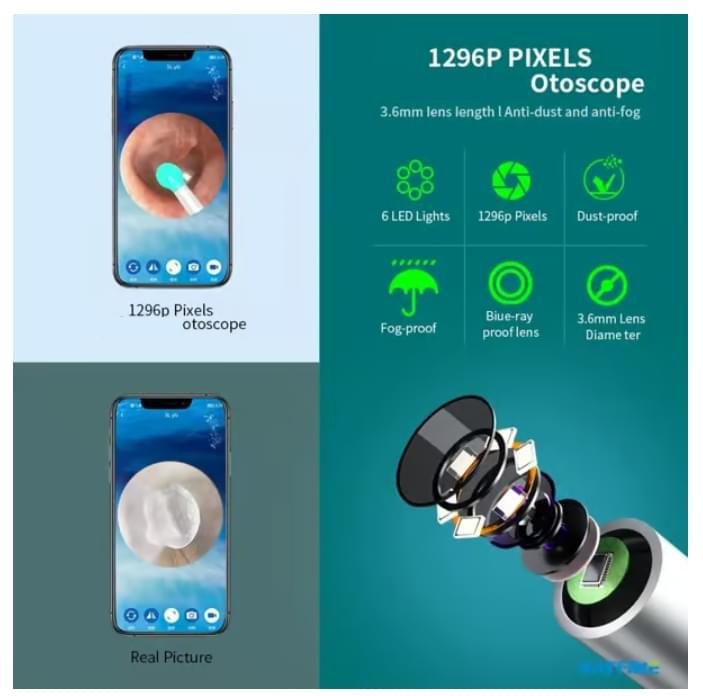 Trådlös smart visuell öronrengörare – USB WiFi-otoskop – Öronvaxborttagningsset med kamera – HD 1080P – kompatibel med iOS och Android